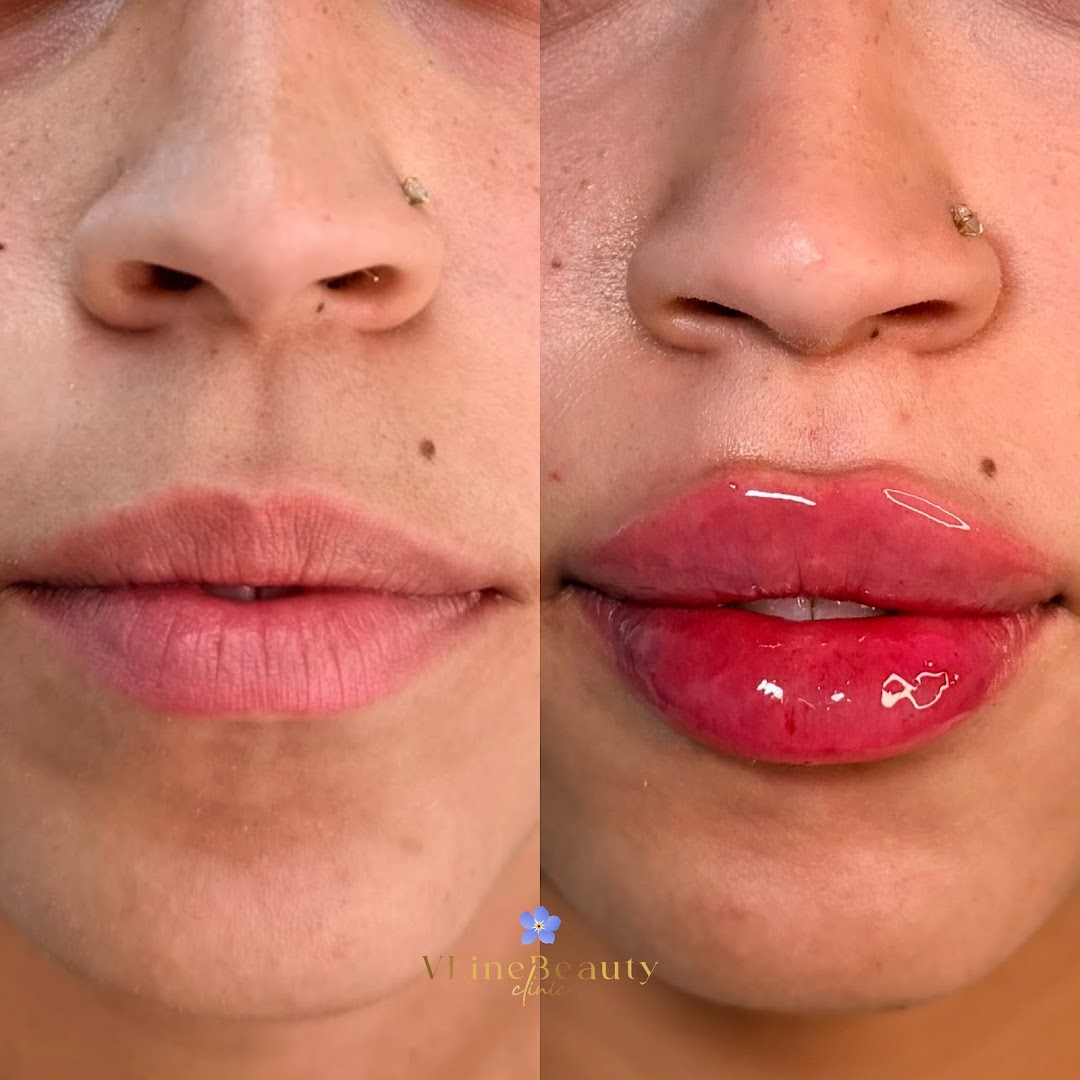 VLine Beauty Clinic